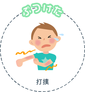 ぶつけた 打撲